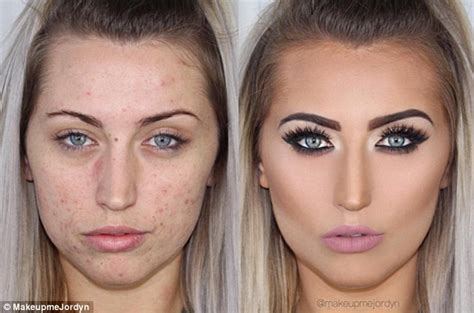 Makeupmejordyn Completely Covers Her Clients Acne In Amazing Make Up