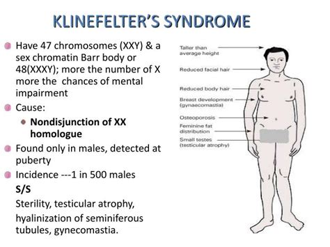 Klinefelters Syndrome Article Presentation