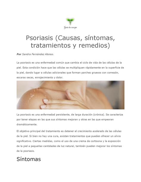 Psoriasis Causas Síntomas Tratamientos Y Remedios By Witi Perez Issuu