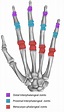 Osteoarthritis in the Hand – Fife Virtual Hand Clinic