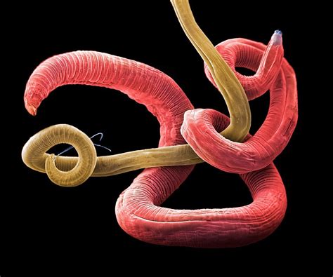 Parasitic Roundworms Sem Bild Kaufen 12378435 Science Photo Library