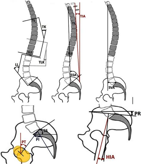 Illustration Of The Spine Pelvis Hip Joint Sagittal Parameter Tk The