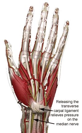 Some people with cts say their fingers feel useless and swollen, even though little or no swelling is apparent. Carpal Tunnel Syndrome