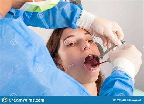 People could utilize their dental and medical insurance to pay for the procedures. Dental extraction stock image. Image of extraction, calculus - 127955187