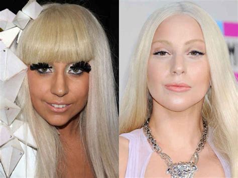 Lady Gaga Before And After Lady Gaga Plastic Surgery Lady Gaga Nose Celebrity Plastic Surgery