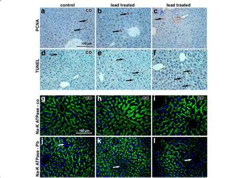 Immunostaining Of Liver Samples Following 6 Weeks Exposure To Pbo Nps