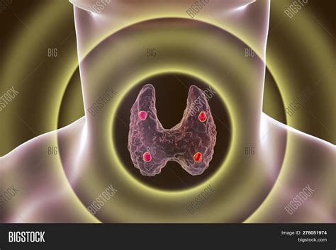 Parathyroid Glands And Thyroid Gland Anatomy 3d Illustration Image