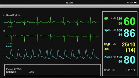 Ekg Heart Footage Videos And Clips In Hd And 4k