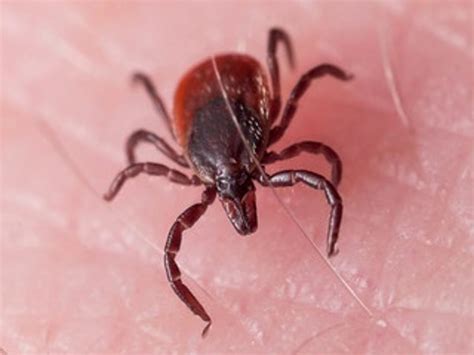 The Growing Threat Of Tick Borne Disease Part I Powassan Virus Access