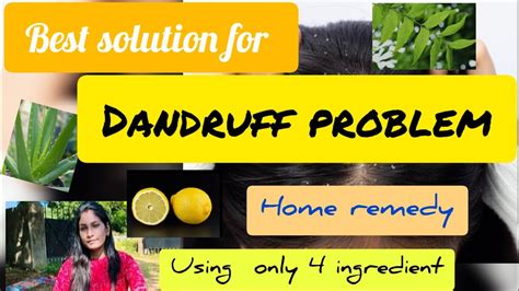 Best Home Remedy For Dandruff Problem Using Only 4 Ingredients