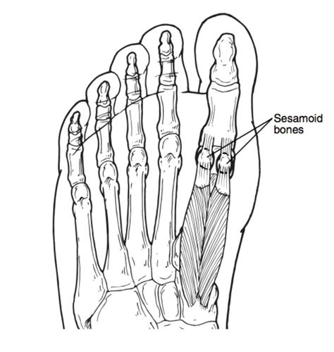 Sesamoid Stress Fractures What Runners Should Know