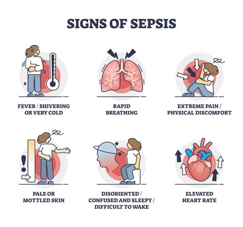 Sepsis A Medical Emergency Jase Medical