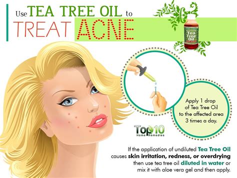 Home Remedies For Acne Top 10 Home Remedies
