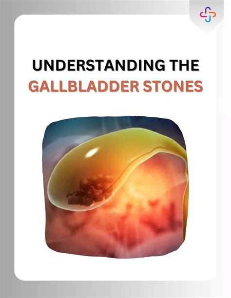 Ppt Understanding The Gallbladder Stones Powerpoint Presentation Free Download Id