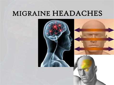 Ppt Approach To Acute Headache In Adults Powerpoint Presentation