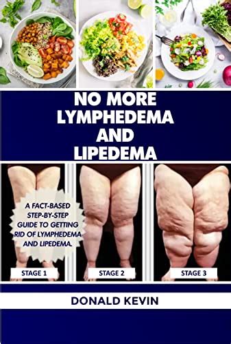 Amazon No More Lymphedema And Lipedema A Fact Based Step By Step