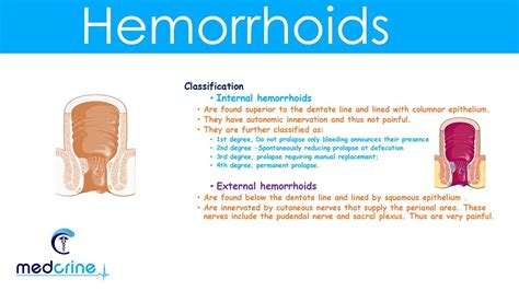 hemorrhoids causes types clinical features diagnosis and treatment youtube