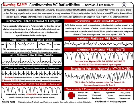 Telemetry Defibrillation Vs Cardioversion Nurse Nursing Notes