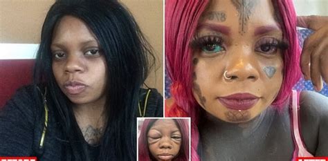 Viral Woman Gets Eye Tattoo To Be Dragon Girl Goes Blind