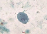 Entamoeba coli parasite | Medical Laboratories