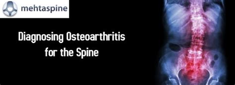 Diagnosing Osteoarthritis For The Spine Spinal Surgeon Mehta Spine Uk