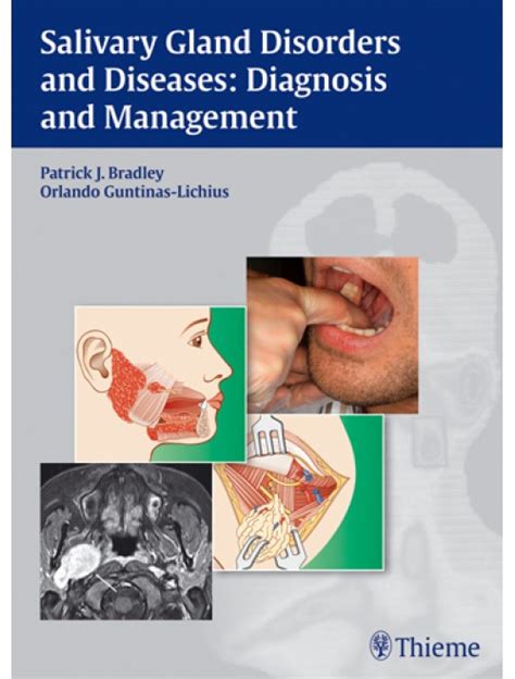 Salivary Gland Disorders And Diseases Diagnosis And Management