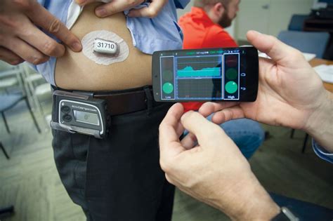 Cystic Fibrosis Diabetes First Fda Approved Artificial Pancreas And