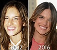 Alessandra Ambrosio chin before and after photo | Alessandra ambrosio ...
