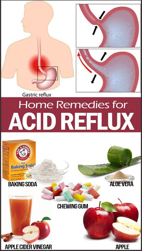 30 Home Remedies For Acid Reflux Remedies Home Remedies For