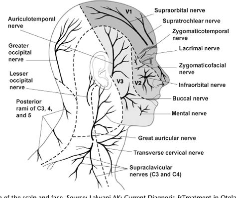 Figure 1 From Scalp Block During Craniotomy A Classic Technique