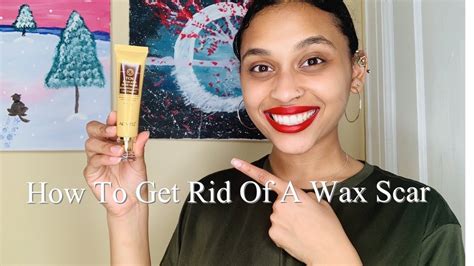 How To Treat A Wax Burn Part2(ANSWERING YOUR QUESTIONS!!) 