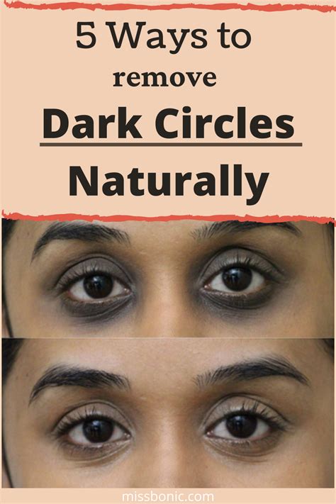 5 Ways To Remove Dark Circles Naturally Remove Dark Circles Dark Circles Around Eyes Dark