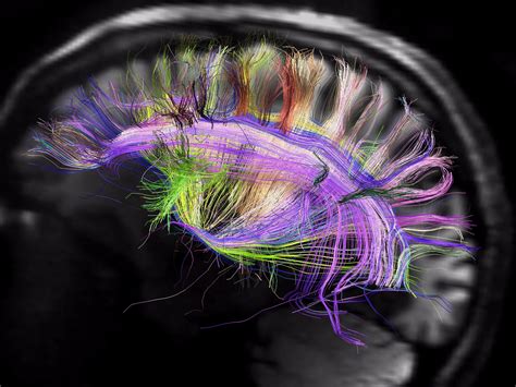 New Brain Map Accomplishes What Scientists Have Been Working On For 100