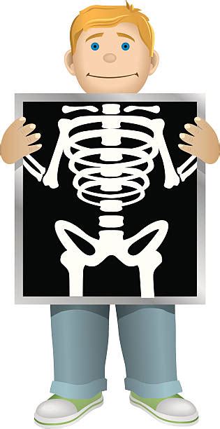Xray Patient Clipart 10 Free Cliparts Download Images On Clipground 2022