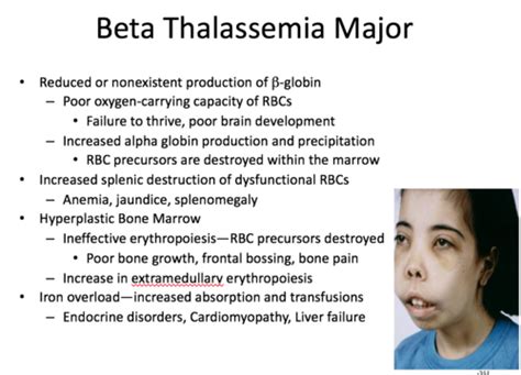 B Thalassemia Major Flashcards Quizlet