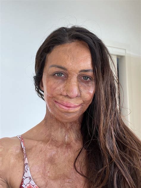 Get A Running Start On Turia Pitt