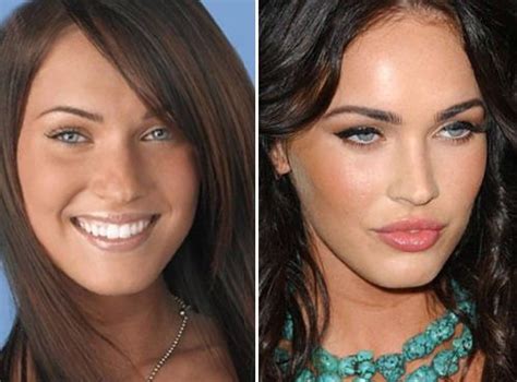 Celebrities Before And After Plastic Surgery Celebrity Plastic