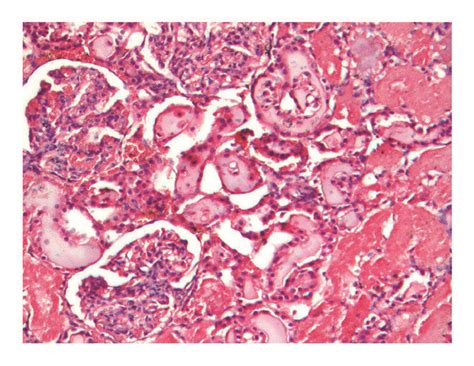 Light Microscopy Of Representative Renal Necropsy Specimens Hande