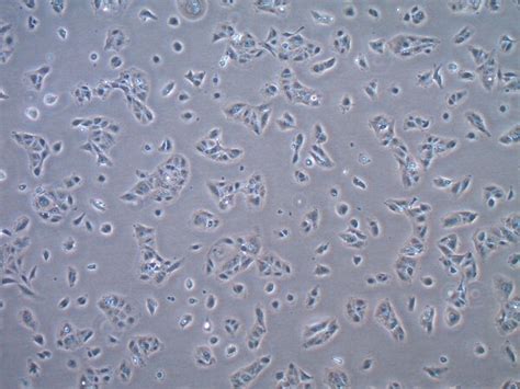 Huh 75 Tet On Human Hepatocellular Carcinoma Cell Line Scc265
