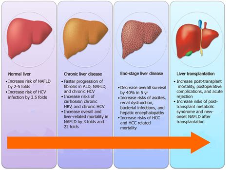 Progress Of Liver Disease Liver