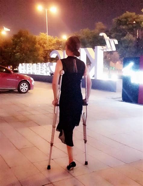 Dak Amputee Girl With Protheses On Crutches 453