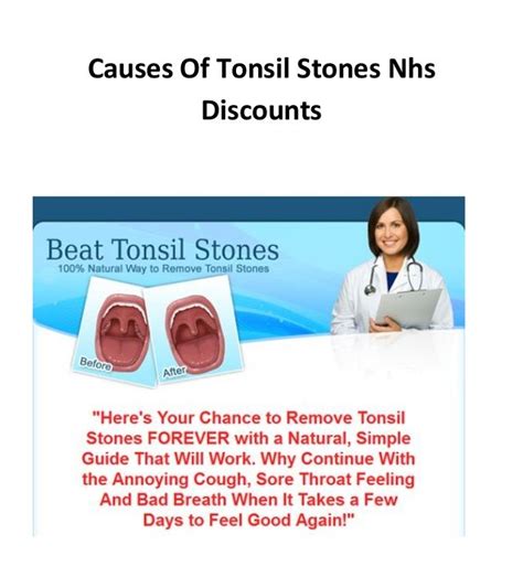 Causes Of Tonsil Stones Nhs Discounts
