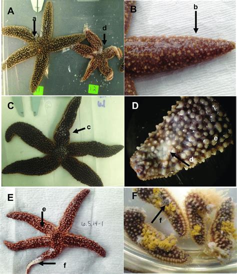 Gross Morphological Signs Of Sea Star Wasting Disease Representative