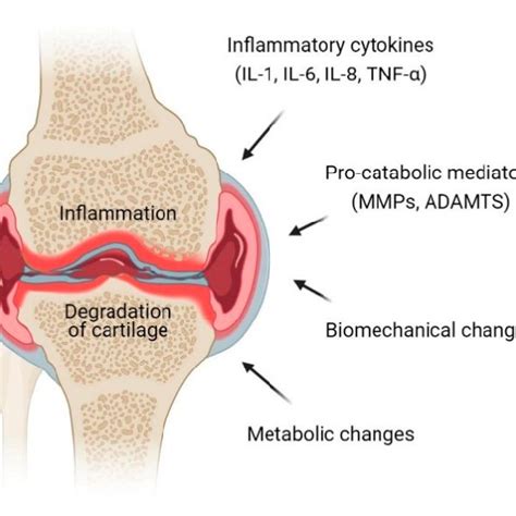 pathophysiology of osteoarthritis oa at the knee joint inflammation download scientific