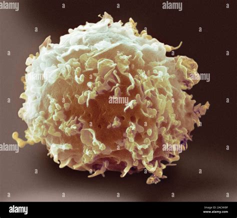 Monocyte White Blood Cell Scanning Electron Micrograph Sem Of A