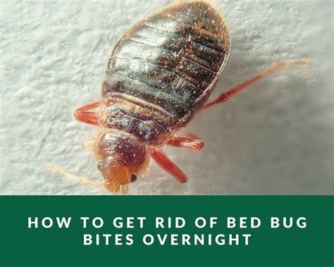 How To Get Rid Of Bed Bug Bites Overnight Zero Pest Ng