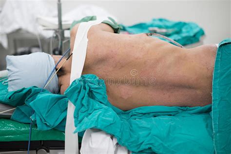 Left Lateral Decubitus Position Stock Photo Image Of Scar Healthcare