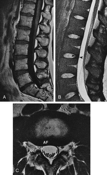 Spine Radiology Key