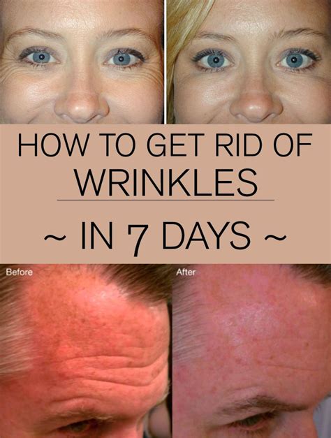 How To Get Rid Of Wrinkles In 7 Days Wrinkles