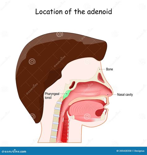 Adenoid Nose